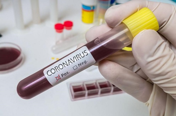 Извършиха тестове за коронавирус на педагогическия и непедадогическия персонал в общинските детски градини